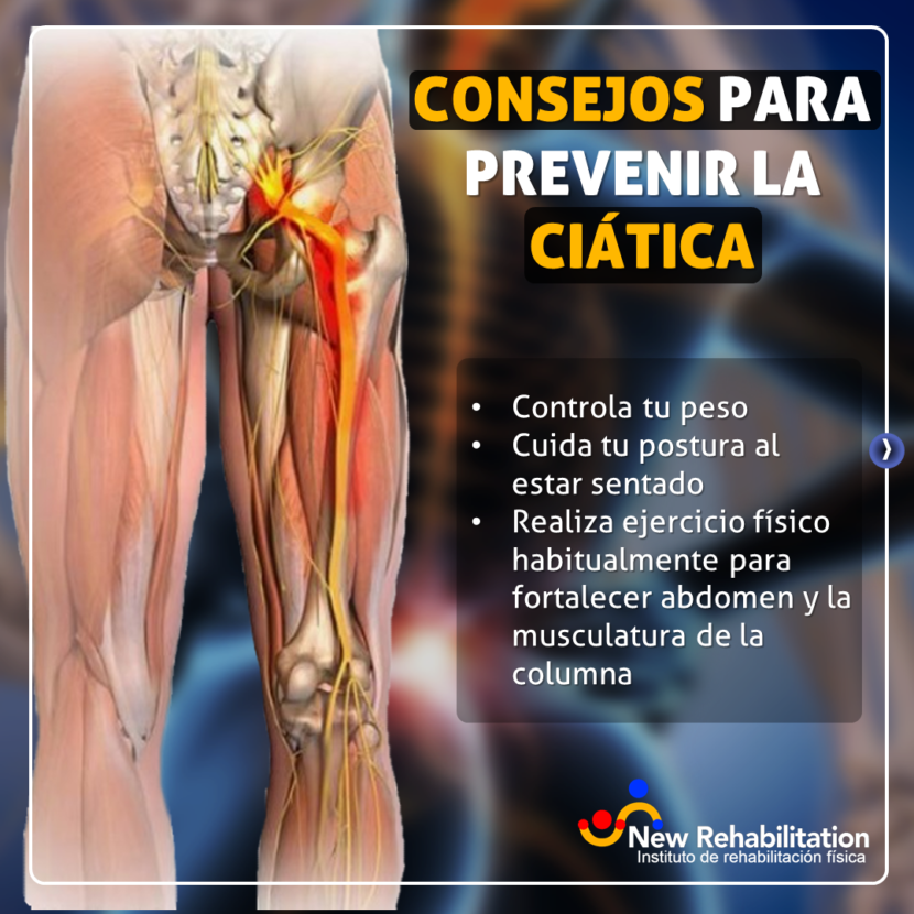 CiÁtica O Dolor Hacia La Pierna New Rehabilitation 1519